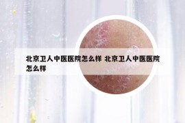 北京衛(wèi)人中醫(yī)醫(yī)院怎么樣 北京衛(wèi)人中醫(yī)醫(yī)院怎么樣