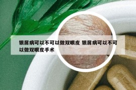 銀屑病可以不可以做雙眼皮 銀屑病可以不可以做雙眼皮手術(shù)