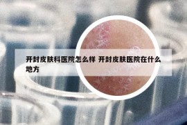 開封皮膚科醫(yī)院怎么樣 開封皮膚醫(yī)院在什么地方