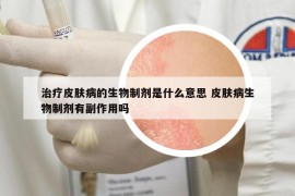 治療皮膚病的生物制劑是什么意思 皮膚病生物制劑有副作用嗎