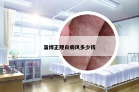 淄博正規(guī)白癜風(fēng)多少錢