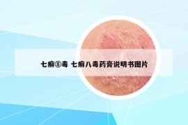 七癬⑧毒 七癬八毒藥膏說明書圖片