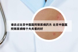 誰去過北京中醫(yī)醫(yī)院銀屑病藥方 北京中醫(yī)醫(yī)院銀屑病哪個大夫看的好