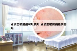 點(diǎn)滴型銀屑病可以撓嗎 點(diǎn)滴型銀屑病能同房嗎
