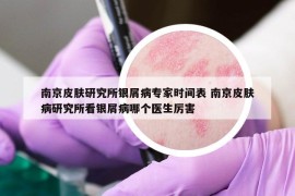 南京皮膚研究所銀屑病專家時(shí)間表 南京皮膚病研究所看銀屑病哪個(gè)醫(yī)生厲害