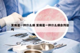 紫癜是一種什么病 紫癜是一種什么病會傳染嗎
