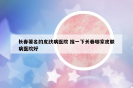長春著名的皮膚病醫(yī)院 搜一下長春哪家皮膚病醫(yī)院好