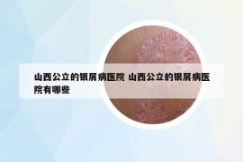 山西公立的銀屑病醫(yī)院 山西公立的銀屑病醫(yī)院有哪些