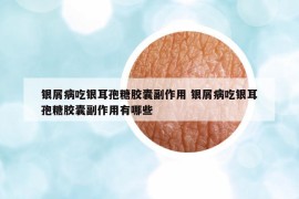 銀屑病吃銀耳孢糖膠囊副作用 銀屑病吃銀耳孢糖膠囊副作用有哪些