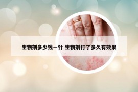 生物劑多少錢一針 生物劑打了多久有效果