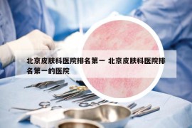 北京皮膚科醫(yī)院排名第一 北京皮膚科醫(yī)院排名第一的醫(yī)院