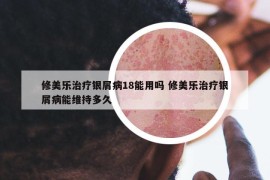 修美樂(lè)治療銀屑病18能用嗎 修美樂(lè)治療銀屑病能維持多久