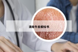 清除牛皮癬標(biāo)書