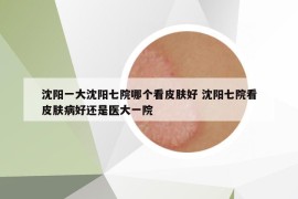 沈陽一大沈陽七院哪個看皮膚好 沈陽七院看皮膚病好還是醫(yī)大一院