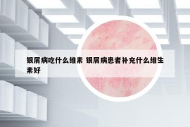 銀屑病吃什么維素 銀屑病患者補充什么維生素好