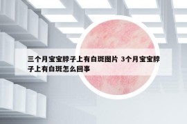 三個月寶寶脖子上有白斑圖片 3個月寶寶脖子上有白斑怎么回事