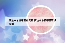 阿達(dá)木單抗哪里有賣(mài)的 阿達(dá)木單抗哪里可以買(mǎi)到