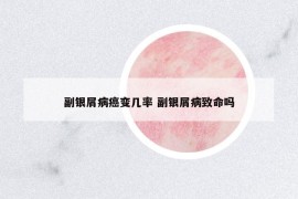 副銀屑病癌變幾率 副銀屑病致命嗎