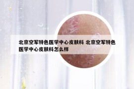 北京空軍特色醫(yī)學中心皮膚科 北京空軍特色醫(yī)學中心皮膚科怎么樣