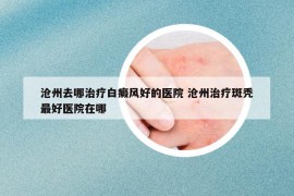 滄州去哪治療白癜風(fēng)好的醫(yī)院 滄州治療斑禿最好醫(yī)院在哪