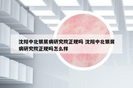 沈陽(yáng)中北銀屑病研究院正規(guī)嗎 沈陽(yáng)中北銀屑病研究院正規(guī)嗎怎么樣