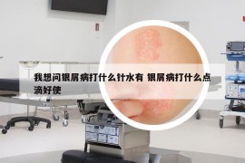 我想問銀屑病打什么針?biāo)?銀屑病打什么點滴好使