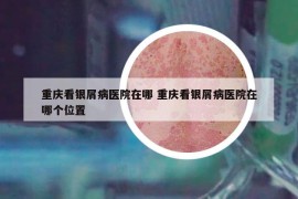重慶看銀屑病醫(yī)院在哪 重慶看銀屑病醫(yī)院在哪個位置