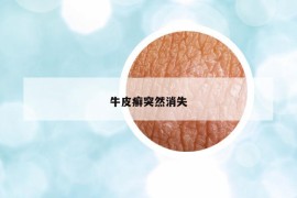 牛皮癬突然消失