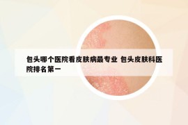 包頭哪個醫(yī)院看皮膚病最專業(yè) 包頭皮膚科醫(yī)院排名第一