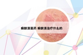 癬膚清苗藥 癬膚清治療什么的