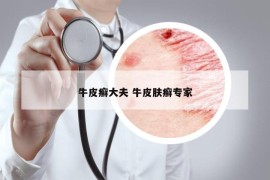 牛皮癬大夫 牛皮膚癬專家