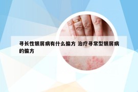 尋長(zhǎng)性銀屑病有什么偏方 治療尋常型銀屑病的偏方
