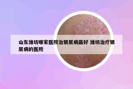 山東濰坊哪家醫(yī)院治銀屑病最好 濰坊治療銀屑病的醫(yī)院
