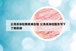 公務(wù)員體檢銀屑病合格 公務(wù)員體檢醫(yī)生寫下了銀屑病