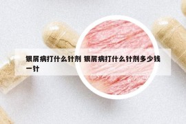 銀屑病打什么針劑 銀屑病打什么針劑多少錢(qián)一針