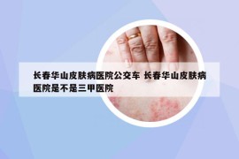 長春華山皮膚病醫(yī)院公交車 長春華山皮膚病醫(yī)院是不是三甲醫(yī)院