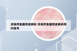 濟(jì)南齊魯醫(yī)院皮膚科 濟(jì)南齊魯醫(yī)院皮膚科預(yù)約掛號(hào)