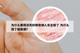 為什么要得該死的銀屑病人生全毀了 為什么得了銀屑病?