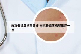 南京看銀屑病那里好 南京看銀屑病那里好一點(diǎn)