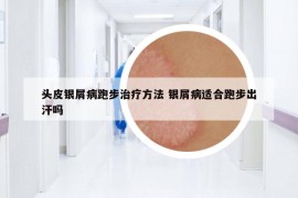 頭皮銀屑病跑步治療方法 銀屑病適合跑步出汗嗎