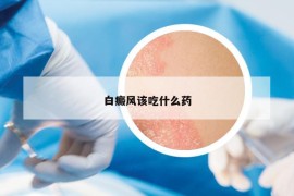 白癜風(fēng)該吃什么藥
