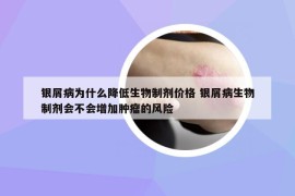 銀屑病為什么降低生物制劑價格 銀屑病生物制劑會不會增加腫瘤的風(fēng)險