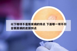 以下哪項不是銀屑病的特點 下面哪一項不符合銀屑病的皮損特點