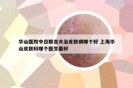 華山醫(yī)院中日聯(lián)吉大治皮膚病哪個好 上海華山皮膚科哪個醫(yī)生最好