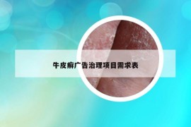 牛皮癬廣告治理項目需求表
