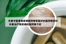 長春中醫(yī)看銀屑病醫(yī)院哪家最好的醫(yī)院哪家好 長春治療銀屑病的醫(yī)院哪個(gè)好