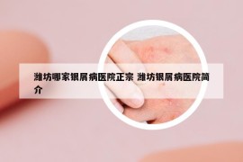 濰坊哪家銀屑病醫(yī)院正宗 濰坊銀屑病醫(yī)院簡介