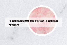 長(zhǎng)春銀屑病醫(yī)院的專(zhuān)家怎么預(yù)約 長(zhǎng)春銀屑病專(zhuān)科醫(yī)院