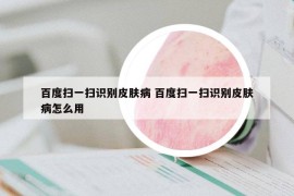 百度掃一掃識(shí)別皮膚病 百度掃一掃識(shí)別皮膚病怎么用