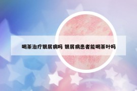 喝茶治療銀屑病嗎 銀屑病患者能喝茶葉嗎